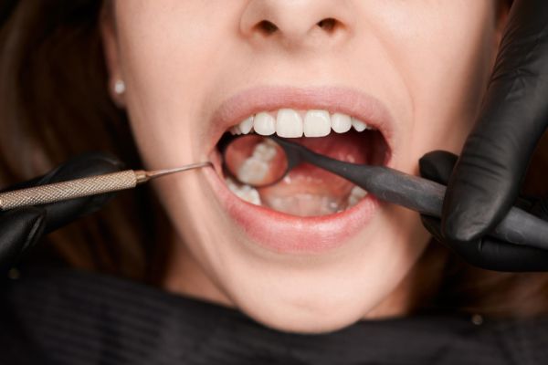 A man wearing metal braces, highlighting his dental treatment.