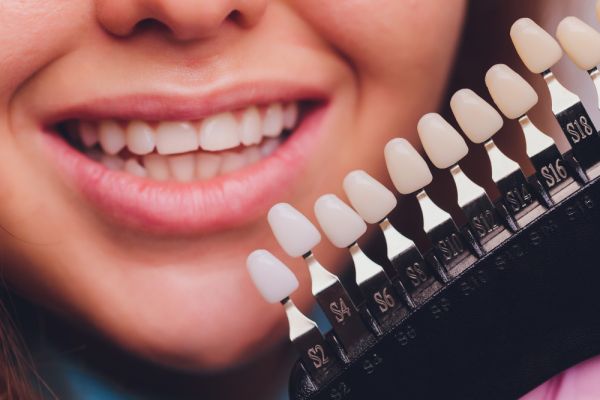 A smiling girl with braces, showcasing her progress in the Fixed Braces Patient Journey.
